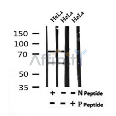 Western blot analysis of Phospho-Lamin A/C (Ser301) in lysates of HeLa, using Phospho-Lamin A/C (Ser301) Antibody(AF7177).