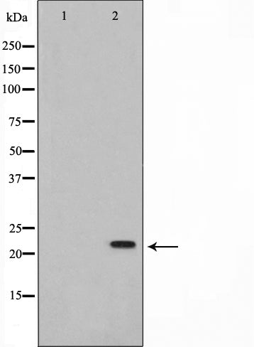 Western blot analysis on K562 cell lysate using NM23 Antibody. The lane on the left is treated with the antigen-specific peptide.
