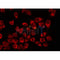 AF0222 staining K562 by IF/ICC. The sample were fixed with PFA and permeabilized in 0.1% Triton X-100,then blocked in 10% serum for 45 minutes at 25¡ãC. The primary antibody was diluted at 1/200 and incubated with the sample for 1 hour at 37¡ãC. An  Alexa Fluor 594 conjugated goat anti-rabbit IgG (H+L) Ab, diluted at 1/600, was used as the secondary antibod