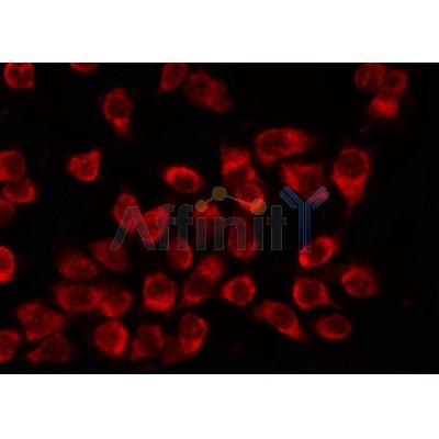 AF0222 staining K562 by IF/ICC. The sample were fixed with PFA and permeabilized in 0.1% Triton X-100,then blocked in 10% serum for 45 minutes at 25¡ãC. The primary antibody was diluted at 1/200 and incubated with the sample for 1 hour at 37¡ãC. An  Alexa Fluor 594 conjugated goat anti-rabbit IgG (H+L) Ab, diluted at 1/600, was used as the secondary antibod