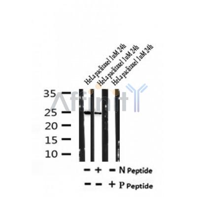 AF7178 at 1/100 staining mouse lung tissue sections by IHC-P. The tissue was formaldehyde fixed and a heat mediated antigen retrieval step in citrate buffer was performed. The tissue was then blocked and incubated with the antibody for 1.5 hours at 22¡ãC. An HRP conjugated goat anti-rabbit antibody was used as the secondary