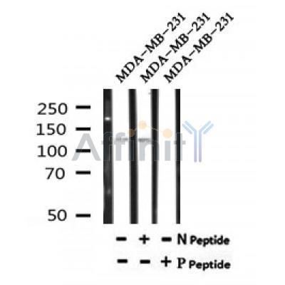 AF7181 at 1/100 staining rat lung tissue sections by IHC-P. The tissue was formaldehyde fixed and a heat mediated antigen retrieval step in citrate buffer was performed. The tissue was then blocked and incubated with the antibody for 1.5 hours at 22¡ãC. An HRP conjugated goat anti-rabbit antibody was used as the secondary