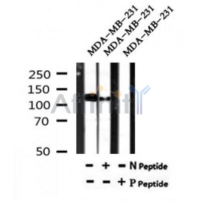 AF7182 at 1/100 staining mouse lung tissue sections by IHC-P. The tissue was formaldehyde fixed and a heat mediated antigen retrieval step in citrate buffer was performed. The tissue was then blocked and incubated with the antibody for 1.5 hours at 22¡ãC. An HRP conjugated goat anti-rabbit antibody was used as the secondary