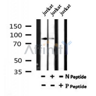 AF7183 at 1/100 staining human kidney tissue sections by IHC-P. The tissue was formaldehyde fixed and a heat mediated antigen retrieval step in citrate buffer was performed. The tissue was then blocked and incubated with the antibody for 1.5 hours at 22¡ãC. An HRP conjugated goat anti-rabbit antibody was used as the secondary