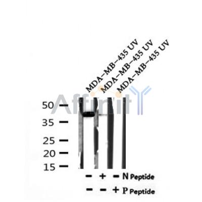 AF7185 at 1/100 staining mouse liver tissue sections by IHC-P. The tissue was formaldehyde fixed and a heat mediated antigen retrieval step in citrate buffer was performed. The tissue was then blocked and incubated with the antibody for 1.5 hours at 22¡ãC. An HRP conjugated goat anti-rabbit antibody was used as the secondary