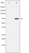 AF3216 staining Hela by IF/ICC. The sample were fixed with PFA and permeabilized in 0.1% Triton X-100,then blocked in 10% serum for 45 minutes at 25¡ãC. The primary antibody was diluted at 1/200 and incubated with the sample for 1 hour at 37¡ãC. An  Alexa Fluor 594 conjugated goat anti-rabbit IgG (H+L) Ab, diluted at 1/600, was used as the secondary antibod