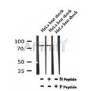 Western blot analysis of Phospho-PKCB (Ser661) in lysates of HeLa heat shock, using Phospho-PKCB (Ser661) Antibody(AF7190).