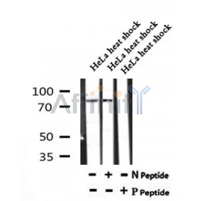 Western blot analysis of Phospho-PKCB (Ser661) in lysates of HeLa heat shock, using Phospho-PKCB (Ser661) Antibody(AF7190).