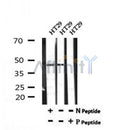 AF7192 at 1/100 staining human colon cancer tissue sections by IHC-P. The tissue was formaldehyde fixed and a heat mediated antigen retrieval step in citrate buffer was performed. The tissue was then blocked and incubated with the antibody for 1.5 hours at 22¡ãC. An HRP conjugated goat anti-rabbit antibody was used as the secondary
