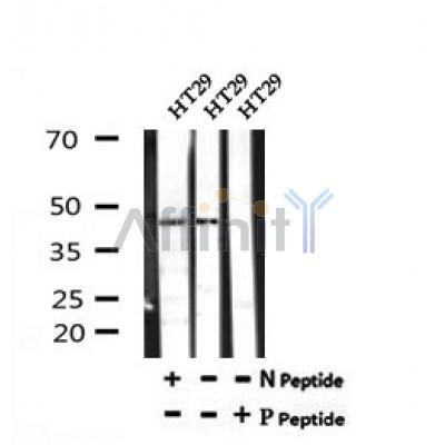 AF7192 at 1/100 staining human colon cancer tissue sections by IHC-P. The tissue was formaldehyde fixed and a heat mediated antigen retrieval step in citrate buffer was performed. The tissue was then blocked and incubated with the antibody for 1.5 hours at 22¡ãC. An HRP conjugated goat anti-rabbit antibody was used as the secondary