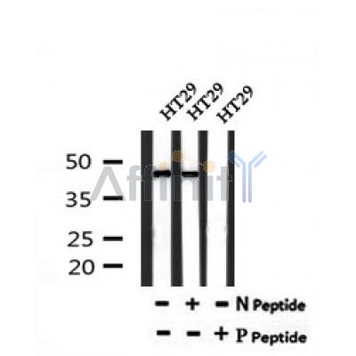 AF7193 at 1/100 staining human colon cancer tissue sections by IHC-P. The tissue was formaldehyde fixed and a heat mediated antigen retrieval step in citrate buffer was performed. The tissue was then blocked and incubated with the antibody for 1.5 hours at 22¡ãC. An HRP conjugated goat anti-rabbit antibody was used as the secondary