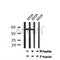AF7193 at 1/100 staining human colon cancer tissue sections by IHC-P. The tissue was formaldehyde fixed and a heat mediated antigen retrieval step in citrate buffer was performed. The tissue was then blocked and incubated with the antibody for 1.5 hours at 22¡ãC. An HRP conjugated goat anti-rabbit antibody was used as the secondary