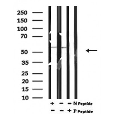 AF7195 at 1/100 staining mouse lung tissue sections by IHC-P. The tissue was formaldehyde fixed and a heat mediated antigen retrieval step in citrate buffer was performed. The tissue was then blocked and incubated with the antibody for 1.5 hours at 22¡ãC. An HRP conjugated goat anti-rabbit antibody was used as the secondary