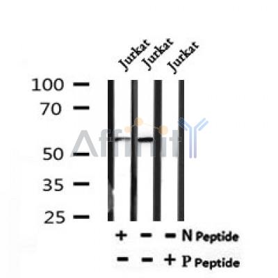 Western blot analysis of Phospho-LCK (Tyr505) in lysates of Jurkat, using Phospho-LCK (Tyr505) Antibody(AF7196).