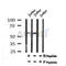 Western blot analysis of Phospho-LCK (Tyr505) in lysates of Jurkat, using Phospho-LCK (Tyr505) Antibody(AF7196).