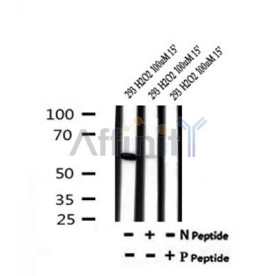 AF7197 at 1/100 staining mouse lung tissue sections by IHC-P. The tissue was formaldehyde fixed and a heat mediated antigen retrieval step in citrate buffer was performed. The tissue was then blocked and incubated with the antibody for 1.5 hours at 22¡ãC. An HRP conjugated goat anti-rabbit antibody was used as the secondary