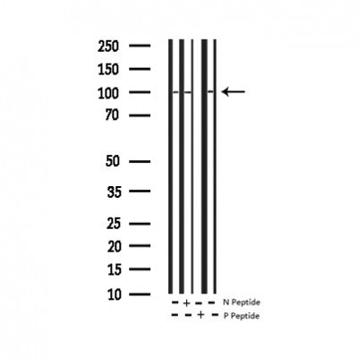 AF3218 staining HeLa by IF/ICC. The sample were fixed with PFA and permeabilized in 0.1% Triton X-100,then blocked in 10% serum for 45 minutes at 25¡ãC. The primary antibody was diluted at 1/200 and incubated with the sample for 1 hour at 37¡ãC. An  Alexa Fluor 594 conjugated goat anti-rabbit IgG (H+L) Ab, diluted at 1/600, was used as the secondary antibod