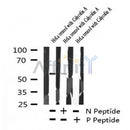 Western blot analysis of Phospho-Vimentin (Tyr117) in lysates of HeLa , using Phospho-Vimentin (Tyr117) Antibody(AF7212).