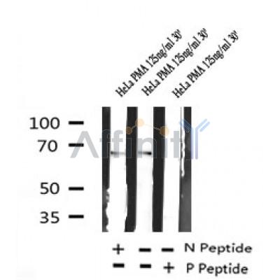 Western blot analysis of Phospho-A-RAF (Thr214) in lysates of HeLa , using Phospho-A-RAF (Thr214) Antibody(AF7214).
