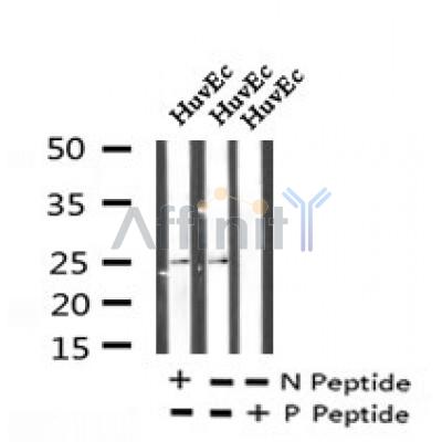 AF7217 at 1/100 staining human brain tissue sections by IHC-P. The tissue was formaldehyde fixed and a heat mediated antigen retrieval step in citrate buffer was performed. The tissue was then blocked and incubated with the antibody for 1.5 hours at 22¡ãC. An HRP conjugated goat anti-rabbit antibody was used as the secondary