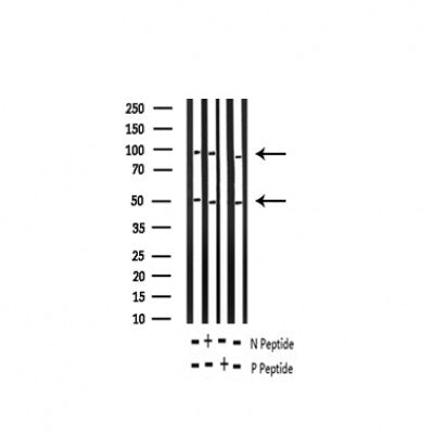 AF3219 staining HeLa by IF/ICC. The sample were fixed with PFA and permeabilized in 0.1% Triton X-100,then blocked in 10% serum for 45 minutes at 25¡ãC. The primary antibody was diluted at 1/200 and incubated with the sample for 1 hour at 37¡ãC. An  Alexa Fluor 594 conjugated goat anti-rabbit IgG (H+L) Ab, diluted at 1/600, was used as the secondary antibod