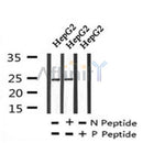 AF7222 at 1/100 staining human gastric cancer tissue sections by IHC-P. The tissue was formaldehyde fixed and a heat mediated antigen retrieval step in citrate buffer was performed. The tissue was then blocked and incubated with the antibody for 1.5 hours at 22¡ãC. An HRP conjugated goat anti-rabbit antibody was used as the secondary