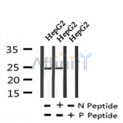 AF7222 at 1/100 staining human gastric cancer tissue sections by IHC-P. The tissue was formaldehyde fixed and a heat mediated antigen retrieval step in citrate buffer was performed. The tissue was then blocked and incubated with the antibody for 1.5 hours at 22¡ãC. An HRP conjugated goat anti-rabbit antibody was used as the secondary