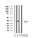 AF7223 at 1/100 staining human liver tissue sections by IHC-P. The tissue was formaldehyde fixed and a heat mediated antigen retrieval step in citrate buffer was performed. The tissue was then blocked and incubated with the antibody for 1.5 hours at 22¡ãC. An HRP conjugated goat anti-rabbit antibody was used as the secondary