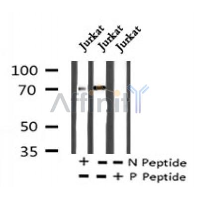 Western blot analysis of Phospho-L-plastin (Tyr300) in lysates of Jurkat?, using Phospho-L-plastin (Tyr300) Antibody(AF7224).