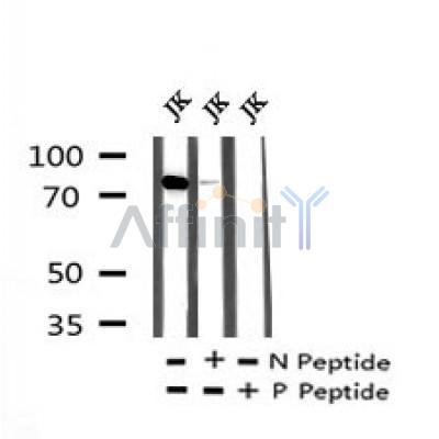 Western blot analysis of Phospho-HS1 (Tyr198) in lysates of HepG2, using Phospho-HS1 (Tyr198) Antibody(AF7226).