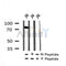 Western blot analysis of Phospho-HS1 (Tyr198) in lysates of HepG2, using Phospho-HS1 (Tyr198) Antibody(AF7226).