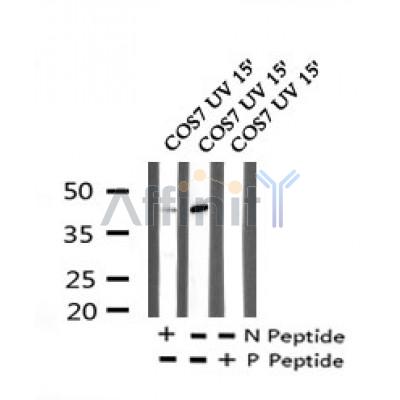 AF7227 at 1/100 staining human liver tissue sections by IHC-P. The tissue was formaldehyde fixed and a heat mediated antigen retrieval step in citrate buffer was performed. The tissue was then blocked and incubated with the antibody for 1.5 hours at 22¡ãC. An HRP conjugated goat anti-rabbit antibody was used as the secondary