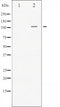 AF3220 staining HeLa by IF/ICC. The sample were fixed with PFA and permeabilized in 0.1% Triton X-100,then blocked in 10% serum for 45 minutes at 25¡ãC. The primary antibody was diluted at 1/200 and incubated with the sample for 1 hour at 37¡ãC. An  Alexa Fluor 594 conjugated goat anti-rabbit IgG (H+L) Ab, diluted at 1/600, was used as the secondary antibod