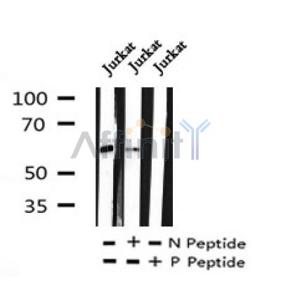 AF7228 at 1/100 staining human gastric cancer tissue sections by IHC-P. The tissue was formaldehyde fixed and a heat mediated antigen retrieval step in citrate buffer was performed. The tissue was then blocked and incubated with the antibody for 1.5 hours at 22¡ãC. An HRP conjugated goat anti-rabbit antibody was used as the secondary