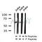 AF7228 at 1/100 staining human gastric cancer tissue sections by IHC-P. The tissue was formaldehyde fixed and a heat mediated antigen retrieval step in citrate buffer was performed. The tissue was then blocked and incubated with the antibody for 1.5 hours at 22¡ãC. An HRP conjugated goat anti-rabbit antibody was used as the secondary