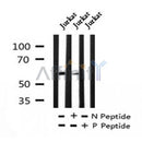 AF7229 at 1/100 staining human gastric cancer tissue sections by IHC-P. The tissue was formaldehyde fixed and a heat mediated antigen retrieval step in citrate buffer was performed. The tissue was then blocked and incubated with the antibody for 1.5 hours at 22¡ãC. An HRP conjugated goat anti-rabbit antibody was used as the secondary