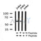 AF7230 at 1/100 staining human gastric cancer tissue sections by IHC-P. The tissue was formaldehyde fixed and a heat mediated antigen retrieval step in citrate buffer was performed. The tissue was then blocked and incubated with the antibody for 1.5 hours at 22¡ãC. An HRP conjugated goat anti-rabbit antibody was used as the secondary