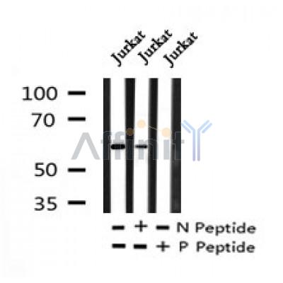 AF7230 at 1/100 staining human gastric cancer tissue sections by IHC-P. The tissue was formaldehyde fixed and a heat mediated antigen retrieval step in citrate buffer was performed. The tissue was then blocked and incubated with the antibody for 1.5 hours at 22¡ãC. An HRP conjugated goat anti-rabbit antibody was used as the secondary