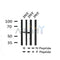 AF7231 at 1/100 staining human gastric cancer tissue sections by IHC-P. The tissue was formaldehyde fixed and a heat mediated antigen retrieval step in citrate buffer was performed. The tissue was then blocked and incubated with the antibody for 1.5 hours at 22¡ãC. An HRP conjugated goat anti-rabbit antibody was used as the secondary