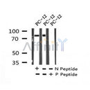 AF7232 at 1/100 staining human brain tissue sections by IHC-P. The tissue was formaldehyde fixed and a heat mediated antigen retrieval step in citrate buffer was performed. The tissue was then blocked and incubated with the antibody for 1.5 hours at 22¡ãC. An HRP conjugated goat anti-rabbit antibody was used as the secondary