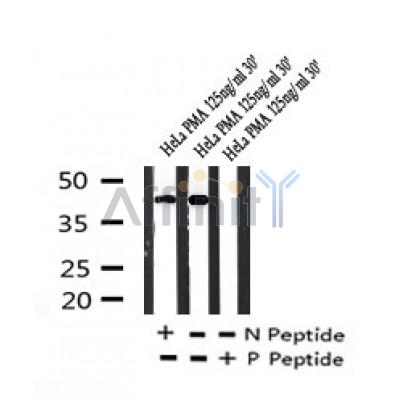 AF7236 at 1/100 staining human brain tissue sections by IHC-P. The tissue was formaldehyde fixed and a heat mediated antigen retrieval step in citrate buffer was performed. The tissue was then blocked and incubated with the antibody for 1.5 hours at 22¡ãC. An HRP conjugated goat anti-rabbit antibody was used as the secondary