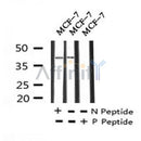 AF7241 at 1/100 staining human gastric cancer tissue sections by IHC-P. The tissue was formaldehyde fixed and a heat mediated antigen retrieval step in citrate buffer was performed. The tissue was then blocked and incubated with the antibody for 1.5 hours at 22¡ãC. An HRP conjugated goat anti-rabbit antibody was used as the secondary
