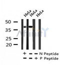 AF7242 at 1/100 staining human gastric cancer tissue sections by IHC-P. The tissue was formaldehyde fixed and a heat mediated antigen retrieval step in citrate buffer was performed. The tissue was then blocked and incubated with the antibody for 1.5 hours at 22¡ãC. An HRP conjugated goat anti-rabbit antibody was used as the secondary