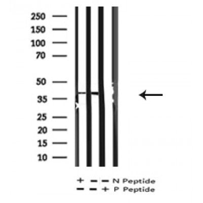 AF7246 at 1/100 staining human kidney tissue sections by IHC-P. The tissue was formaldehyde fixed and a heat mediated antigen retrieval step in citrate buffer was performed. The tissue was then blocked and incubated with the antibody for 1.5 hours at 22¡ãC. An HRP conjugated goat anti-rabbit antibody was used as the secondary