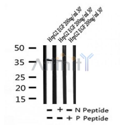 Western blot analysis of Phospho-C/EBPbeta (Ser76) in lysates of HepG2 EGF 200ng/ml 30', using Phospho-C/EBPbeta (Ser76) Antibody(AF7247).