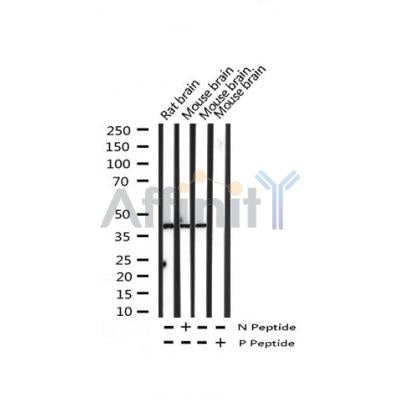 AF3223 staining 293 by IF/ICC. The sample were fixed with PFA and permeabilized in 0.1% Triton X-100,then blocked in 10% serum for 45 minutes at 25¡ãC. The primary antibody was diluted at 1/200 and incubated with the sample for 1 hour at 37¡ãC. An  Alexa Fluor 594 conjugated goat anti-rabbit IgG (H+L) Ab, diluted at 1/600, was used as the secondary antibod