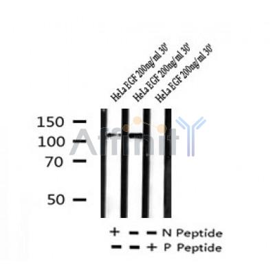 AF7264 at 1/100 staining human kidney tissue sections by IHC-P. The tissue was formaldehyde fixed and a heat mediated antigen retrieval step in citrate buffer was performed. The tissue was then blocked and incubated with the antibody for 1.5 hours at 22¡ãC. An HRP conjugated goat anti-rabbit antibody was used as the secondary
