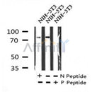 AF7268 at 1/100 staining human gastric cancer tissue sections by IHC-P. The tissue was formaldehyde fixed and a heat mediated antigen retrieval step in citrate buffer was performed. The tissue was then blocked and incubated with the antibody for 1.5 hours at 22¡ãC. An HRP conjugated goat anti-rabbit antibody was used as the secondary