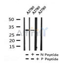 Western blot analysis of Phospho-CDK1/CDC2 (Tyr15) in lysates of A2780, using Phospho-CDK1/CDC2 (Tyr15) Antibody(AF7274).