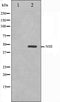 Western blot analysis on HepG2 cell lysate using NSE Antibody. The lane on the left is treated with the antigen-specific peptide.